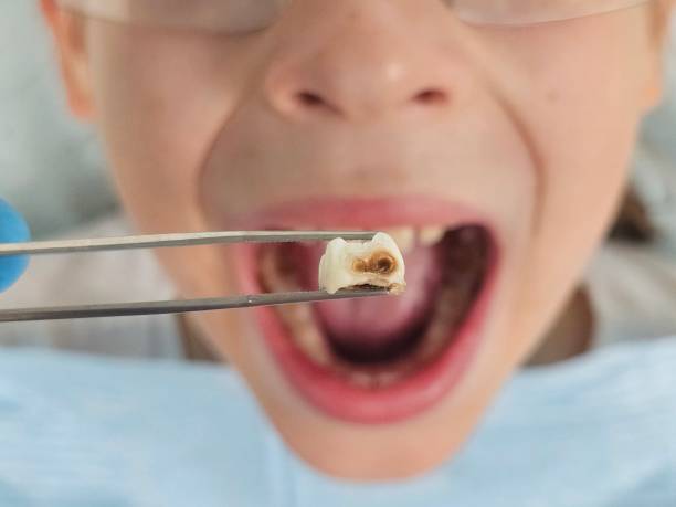 Best Same-Day Emergency Dentist in Patton Village, TX